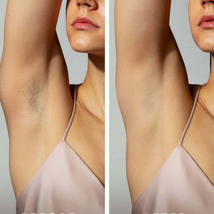 DEPILADOR LASER PREMIUM IPL ORIGINAL