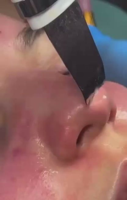 LIMPIADOR FACIAL ULTRASONICO